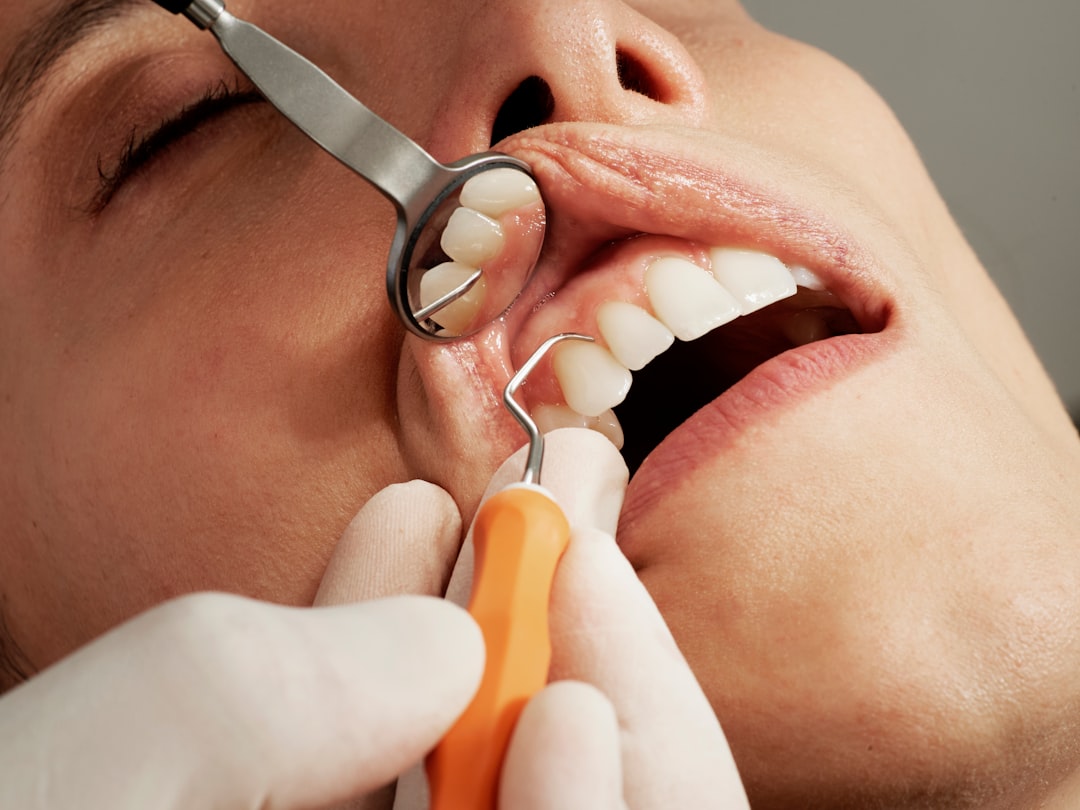 ¿Cada cuánto hay que hacerse una limpieza dental? El sarro no se va cepillando